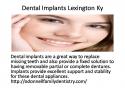 79387_dental_implants_lexington_ly.